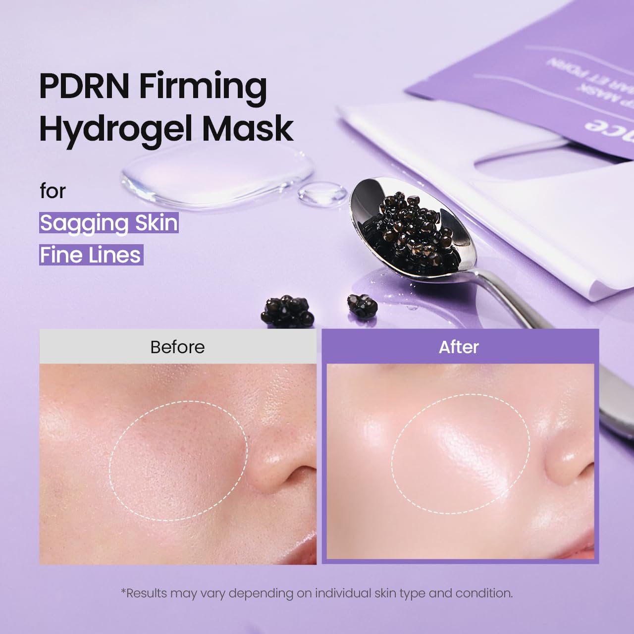 BIODANCE Rejuvenating Caviar PDRN Real Deep Mask, Overnight Hydrogel Face Mask, Skin Firming, Radiance, Enhancing Skin Recovery, Korean Skin Care | 1.19oz(34g) x 4ea - Image 3