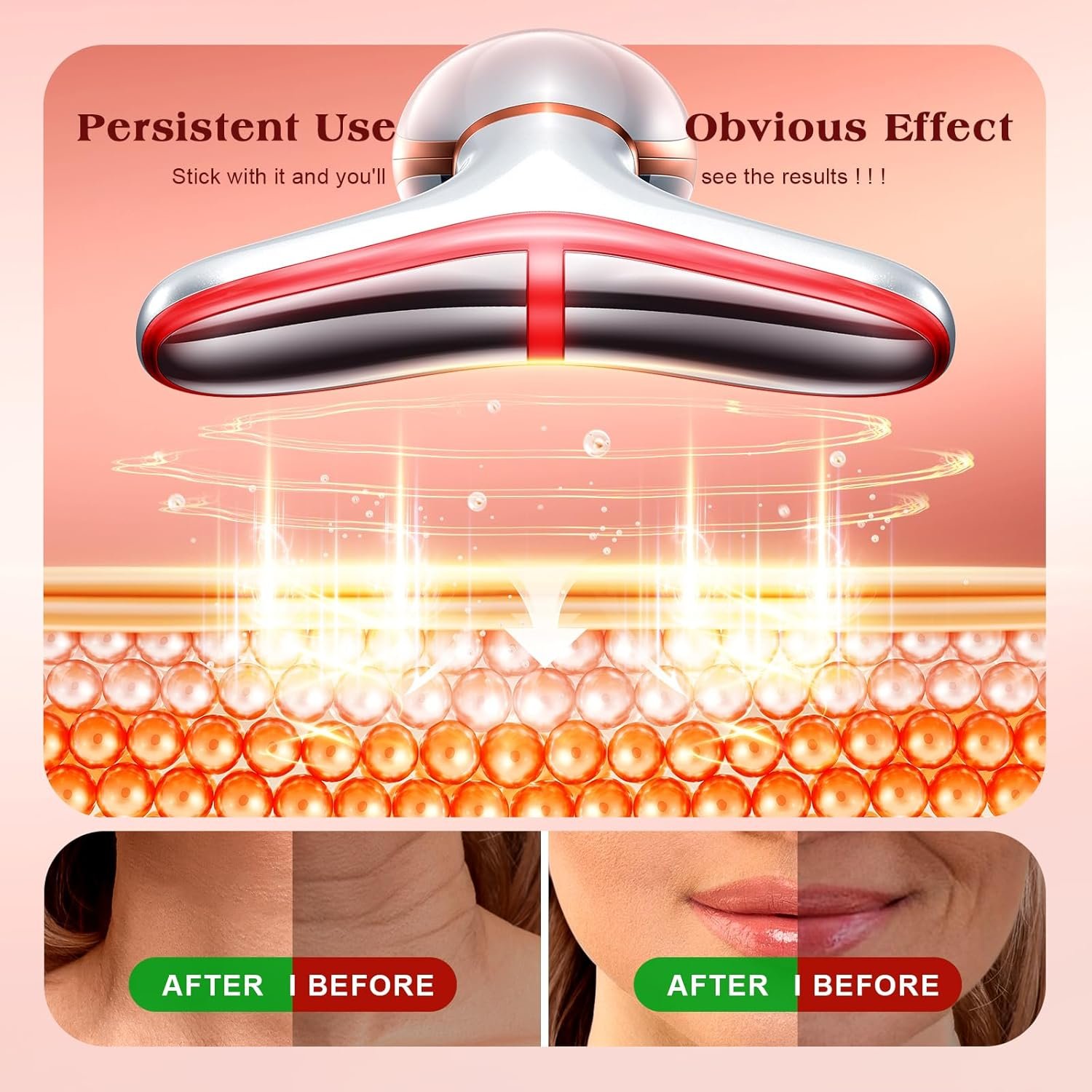 Facial Massager, 7 Colors Red Light Therapy for Face and Neck, Face Lift Device with 113°F Heating Vibration for Multi Skin Care - Image 4